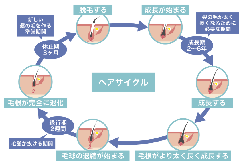 DMMオンラインクリニック AGA ミノキシジル