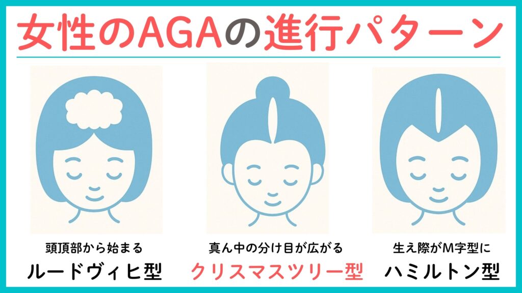 女性のAGA(FAGA)とは